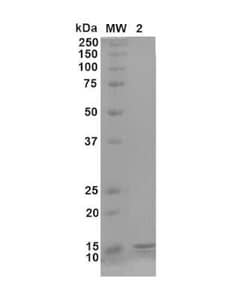 Novus Biologicals Recombinant Human gamma-Synuclein Active, Monomer Protein 100 &mu;g | Buy Online | Novus Biologicals | Fisher Scientific
